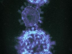 10 Foto Virus Jahat yang Dipotret Mikroskop, Bikin Terperangah