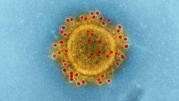 Gambar ini menunjukkan bentuk sempurna dari Virus Corona yang umum kita lihat.