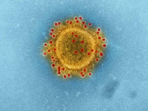 Ilmuwan China Ciptakan Virus Mutan Ebola, Timbulkan Gejala Mengerikan