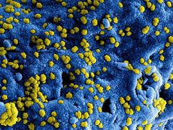 10 Foto Virus Jahat yang Dipotret Mikroskop, Bikin Terperangah