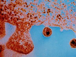 10 Foto Virus Jahat yang Dipotret Mikroskop, Bikin Terperangah