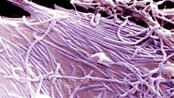 Lanjut, ada virus Ebola yang gambarnya dihasilkan dari pemindaian mikrograf elektron.