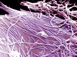 10 Foto Virus Jahat yang Dipotret Mikroskop, Bikin Terperangah