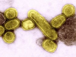 10 Foto Virus Jahat yang Dipotret Mikroskop, Bikin Terperangah