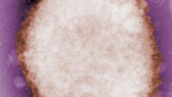 Pertama, ada gambar mikroskopis dari partikel virus cacar monyet.