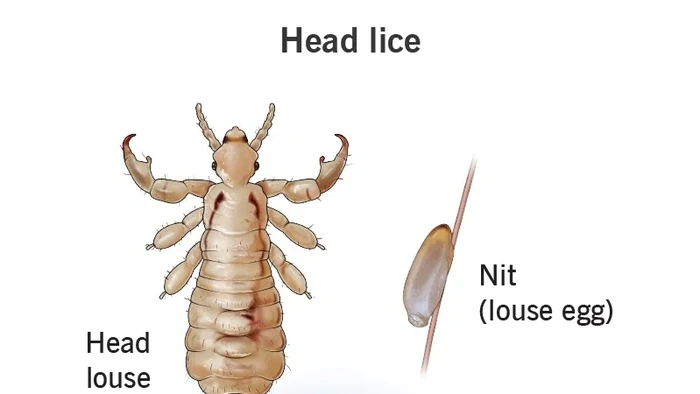 Ilustrasi siklus hidup kutu rambut.
