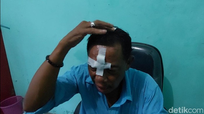 Seorang kepala cabang perusahaan jasa tenaga kerja Indonesia (PJTKI) di Kendal yang mengaku menjadi korban penganiayaan, Rabu (3/8/2022).