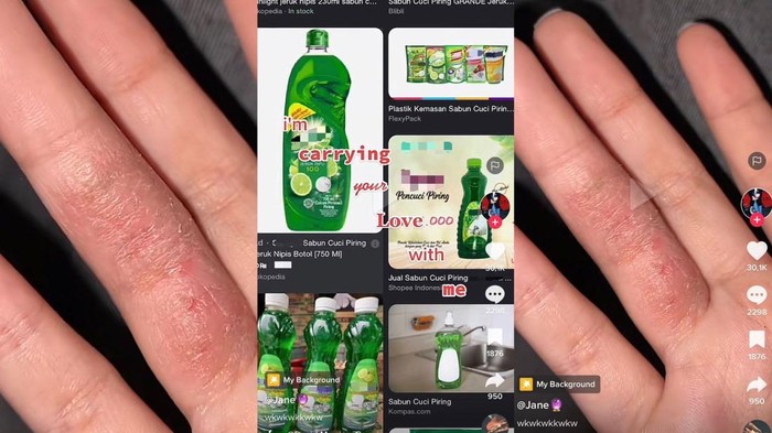 iritasi karena sabun cuci piring iritasi karena sabun cuci piring