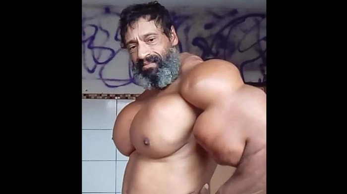 Potret Binaragawan Suntik Otot Pakai Minyak demi Mirip Hulk, Akhir Hidupnya Miris