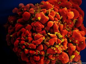 Cegah Ledakan Kasus, Pengendalian HIV/AIDS Butuh Dana Miliaran Dolar AS