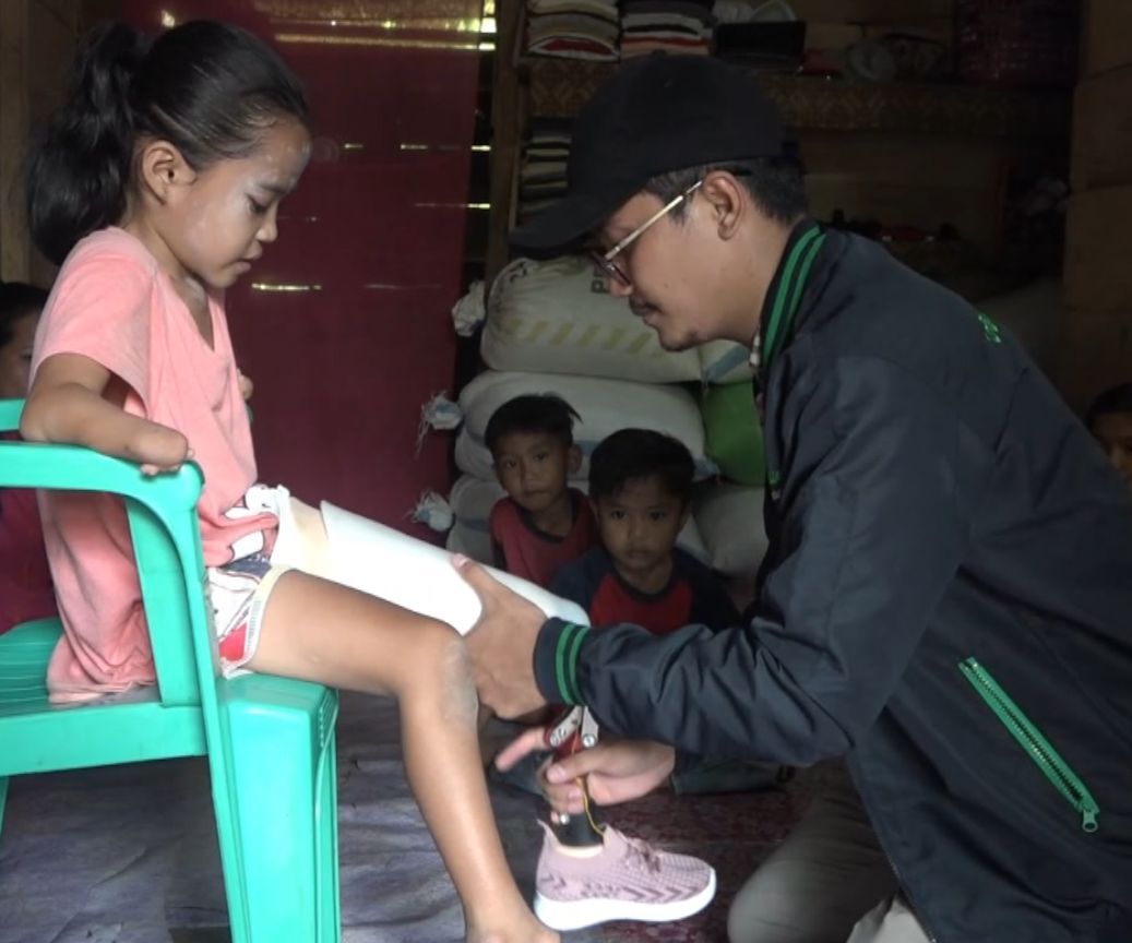 Fitriani Bocah Tanpa Kaki Dapat Kaki Palsu dan Toilet Baru
