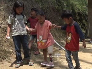 Hore! Berkat Sahabat Baik, Fitiriani Punya Kaki Palsu hingga Toilet Baru
