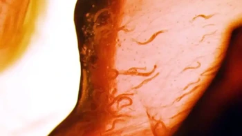 Tragedi Space Shuttle Columbia pada tahun 2003 berujung pada kematian tujuh awaknya. Tapi ada satu makhluk yang berhasil selamat dari kecelakaan mengerikan ini yaitu cacing Caenorhabditis elegans. Cacing-cacing ini bukan hanya berhasil selamat tapi juga bisa bereproduksi hingga lima generasi setelahnya. Foto: NASA/Ames/Volker Kern