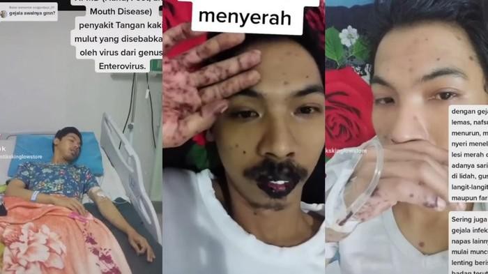 Satrio, pria asal Madiun yang terkena flu Singapura