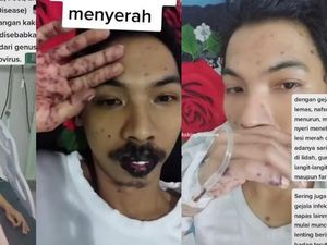 Cerita di Balik Viral Pria Madiun Kena Flu Singapura, Sempat Koma