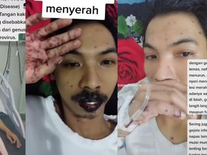 Heboh Pria Madiun Ceritakan Kronologi Kena Flu Singapura hingga Sempat Koma