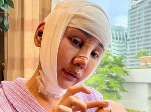 Habis Operasi Wajah, Bisakah Lewat Imigrasi? Ini Cerita Lucinta Luna
