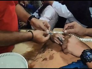 Damkar Lepaskan Cincin dari Jari Bocah SD yang Mulai Membengkak