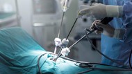 Kenali Kelebihan & Manfaat Teknologi Operasi Laparoskopi untuk Pasien