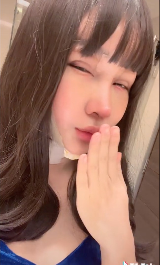 Setelah menjalani serangkaian operasi plastik, Lucinta Luna kerap tampil mengenakan perban di kepalanya. Usai perban tersebut dicopot, Lucinta juga masih terlihat menutupi penampilannya dengan mengenakan topeng wajah atau filter yang membuat bentuk wajahnya tak terlihat jelas. Foto: TikTok/@lucintaluna12