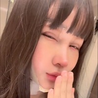 Setelah menjalani serangkaian operasi plastik, Lucinta Luna kerap tampil mengenakan perban di kepalanya. Usai perban tersebut dicopot, Lucinta juga masih terlihat menutupi penampilannya dengan mengenakan topeng wajah atau filter yang membuat bentuk wajahnya tak terlihat jelas. Foto: TikTok/@lucintaluna12