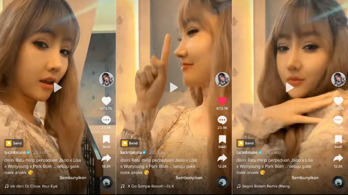 Lucinta Luna Potret Wajah Baru Lucinta Luna Pasca Operasi Ganti Kepala-Potong Leher