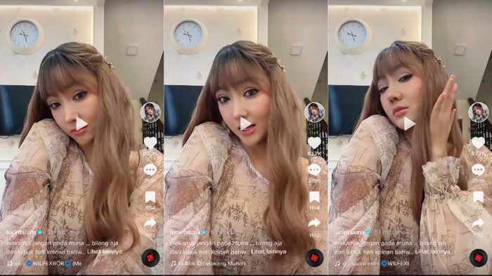 Potret 'Wajah Baru' Lucinta Luna Pasca Operasi Ganti Kepala-Potong Leher