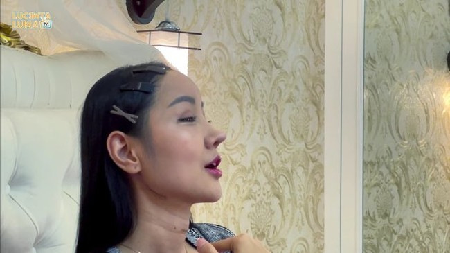 Begini bentuk wajah baru Lucinta Luna jika dilihat dari samping. Hidungnya terlihat jadi lebih mancung dan rahangnya pun jadi jauh lebih kecil. Foto: YouTube/Lucinta Luna TV