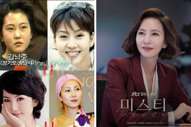Kim Nam Joo merasa operasi plastik bukan hal tabu yang perlu disembunyikan. Aktris yang dikenal dengan perannya dalam drama Korea Misty itu merasa lebih baik mengakuinya ketimbang ketahuan oplas. Foto: dok. JTBC
