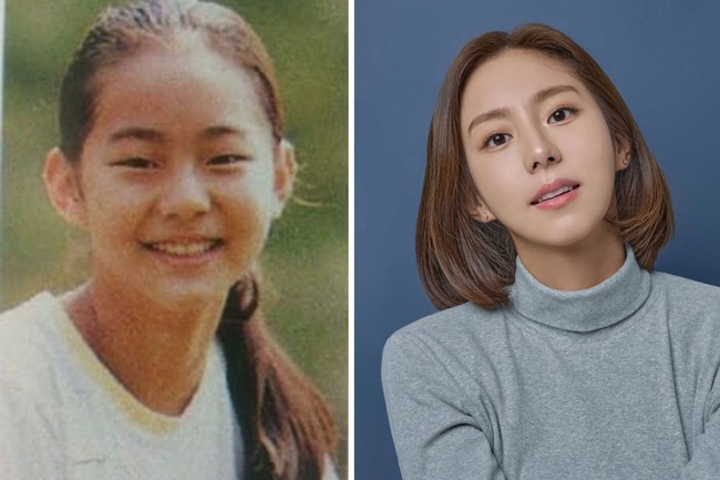 Untuk menambah rasa percaya diri, bintang drama Korea Ghost Doctor ini membuat kelopak mata ganda. Hal itu juga diakui kakak perempuan Uee di acara televisi Sweet Home Town Visit Dal Gona. Foto: dok. Instagram @kim_uieing49