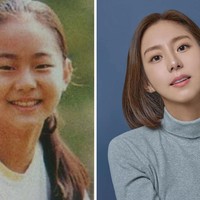Untuk menambah rasa percaya diri, bintang drama Korea Ghost Doctor ini membuat kelopak mata ganda. Hal itu juga diakui kakak perempuan Uee di acara televisi Sweet Home Town Visit Dal Gona. Foto: dok. Instagram @kim_uieing49