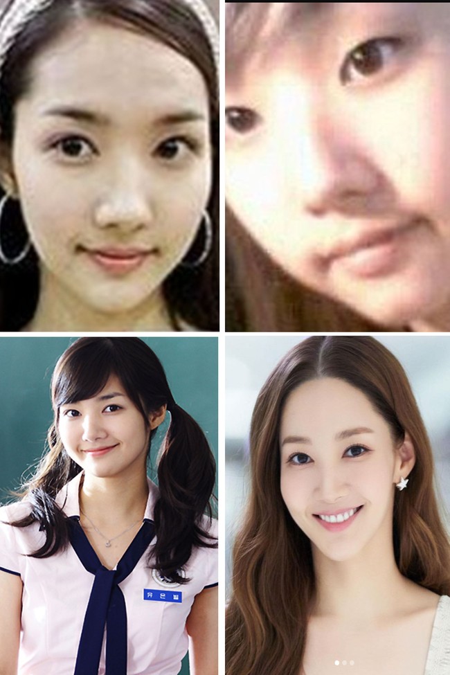 Park Min Young blak-blakan mengaku melakukan operasi plastik pada bagian hidung dan kelopak mata ganda. Pasalnya pada 2010, dia diduga oplas saat foto-fotonya semasa SMA viral di media sosial. Foto: dok. Instagram @rachel_mypark