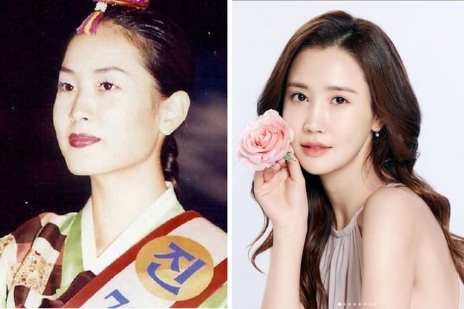 Lee Da Hee populer di awal tahun 2000an saat membintangi drama Korea My Girl bersama Lee Dong Wook. Dia mengubah struktur wajahnya karena pernah mengalami obesitas. Setelah memenangkan kontes kecantikan, Lee Da Hee punya dagu yang lebih runcing dan hidung yang lebih mancung. Foto: dok. Instagram @leedahey4eva