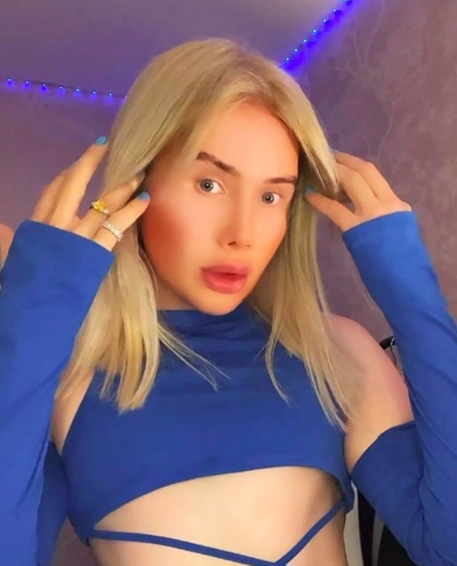 “Aku kecanduan TikTok yang membuatku tertekan dengan penampilan diriku. Aku melihat TikTok delapan jam sehari dan sering membuat video. TikTok adalah bagian dari diriku. Aku orang yang obsesi dan impulsif. Aku banyak menemui wanita cantik Korea di TikTok dan memutuskan untuk seperti mereka,” aku Olu, seperti dikutip dari Mirror. Foto: dok. Instagram/@londonoli