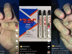 Viral Pria Tangerang Tunjukkan Kuku Ambyar Gegara Spidol, Begini Ceritanya