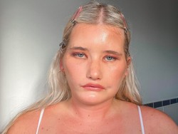 8 Foto Wanita Punya Sindrom Tak Bisa Senyum, Wajah Manyunnya Laris Jadi Model