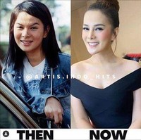 Perbedaan wajah Astrid dulu dan kini juga sempat menjadi viral di media sosial. Ia dituding telah melakukan oplas. Namun menurut penjelasannya saat menjadi bintang tamu di acara FYP (For Your Pagi) Trans 7 yang dipandu oleh Raffi Ahmad dan Irfan Hakim, Astrid dengan tegas menampik hal tersebut. Ia mengaku hanya melakukan tarik benang untuk bagian hidungnya. Foto: Instagram/@artis.indo_hits