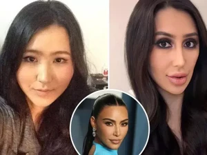 Wanita Korea Implan Payudara 34GGG, Berubah Total Demi Mirip Kim Kardashian