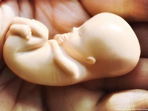 Cerita Dokter E Sang Raja Aborsi Surabaya