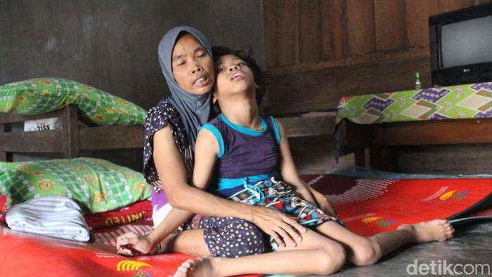Ibu di Jombang rawat anak penderita gangguan syaraf otak