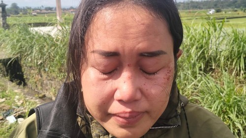 Korban bernama Ni Luh Putu Sukma Lusiana Putri terluka akibat terkena tembakan softgun