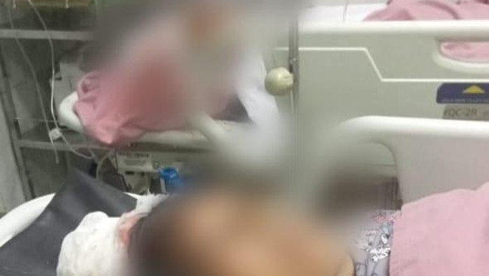 Foto korban pembacokan OTK di Bandar Lampung. Istimewa