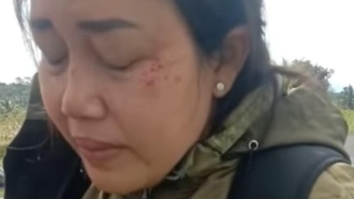 Pengendara sepeda motor di Jalan Raya Ayunan, Desa Ayunan, Kecamatan Abiansemal, Kabupaten Badung terkena tembakan softgun.