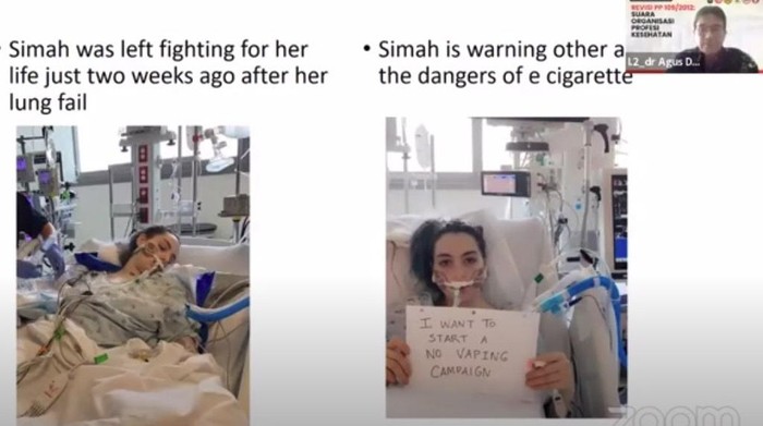 Pengguna rokok dan vape Pengguna rokok dan vape berakhir dirawat di ICU, menggunakan ventilator.