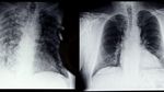 Deretan Foto X-Ray yang Bikin Merinding