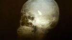 Deretan Foto X-Ray yang Bikin Merinding