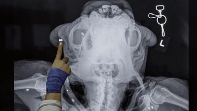 Deretan Foto X-Ray yang Bikin Merinding