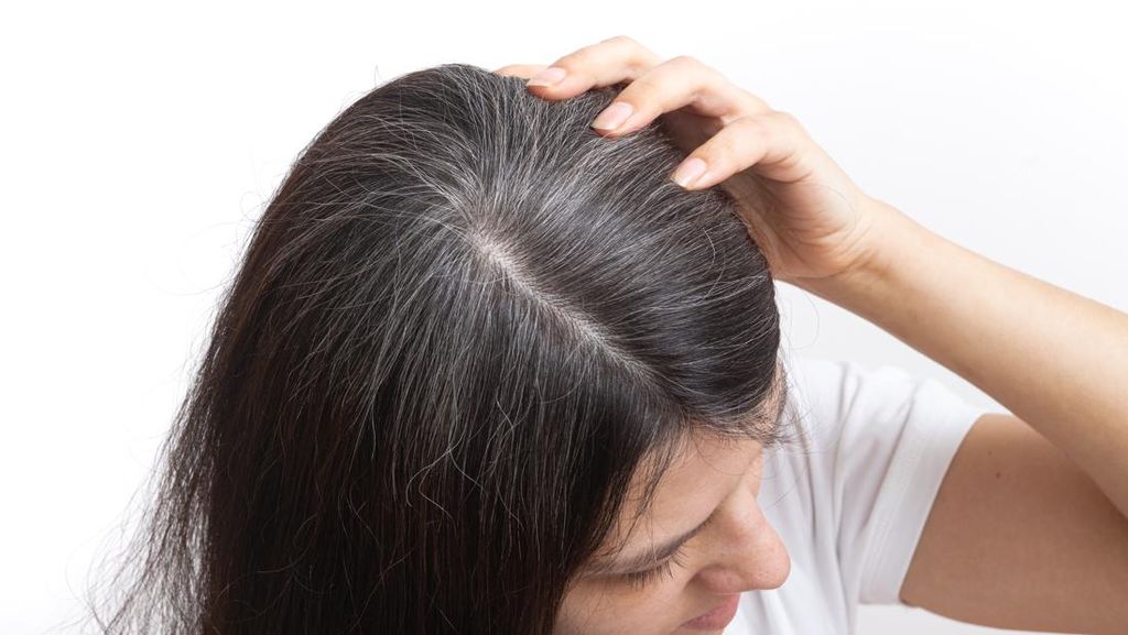 Rambut Bisa Kembali Hitam saat Stres Berkurang? Ini Jawaban Peneliti