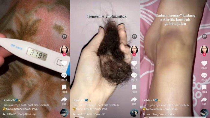 Tangkapan layar akun Tiktok Zia @latizsch (Diambil atas izin yang bersangkutan) autoimun