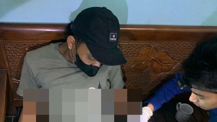 Pria Sidoarjo yang meminta bantuan melepas cincin dari kelaminnya